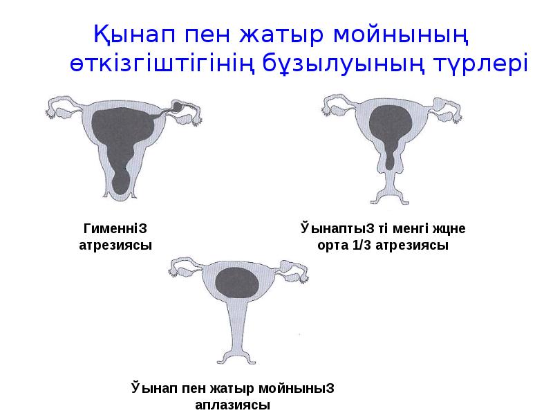 Қынап пен жатыр мойнының өткізгіштігінің бұзылуының түрлері Қынап пен жатыр мойнының өткізгіштігінің бұзылуының түрлері