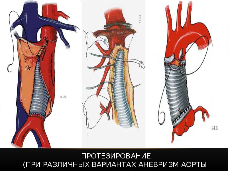 Нарушение кровообращения хирургия презентация