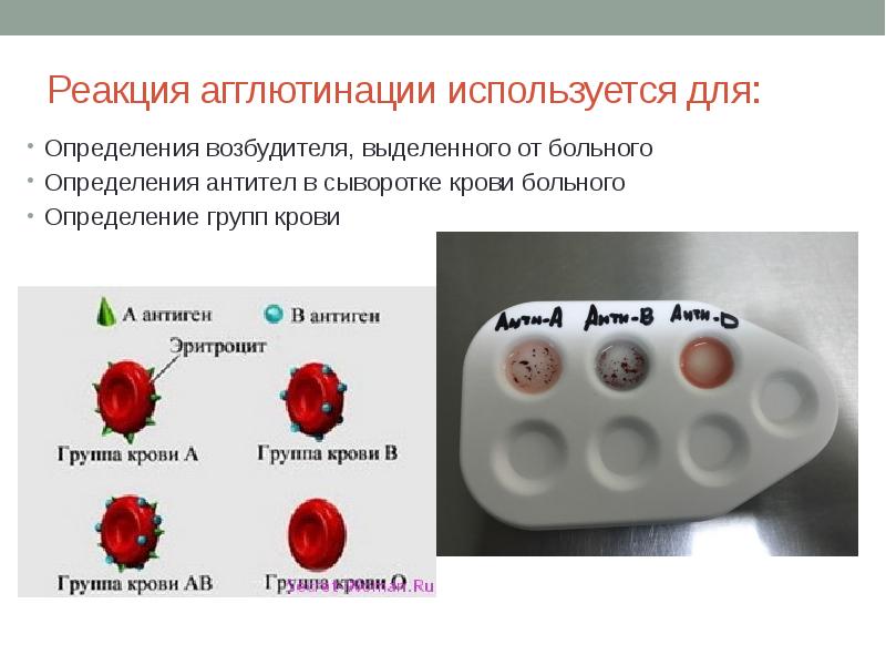 Если на эритроцитах обнаружен только антиген в исследуемый образец крови относится к группе