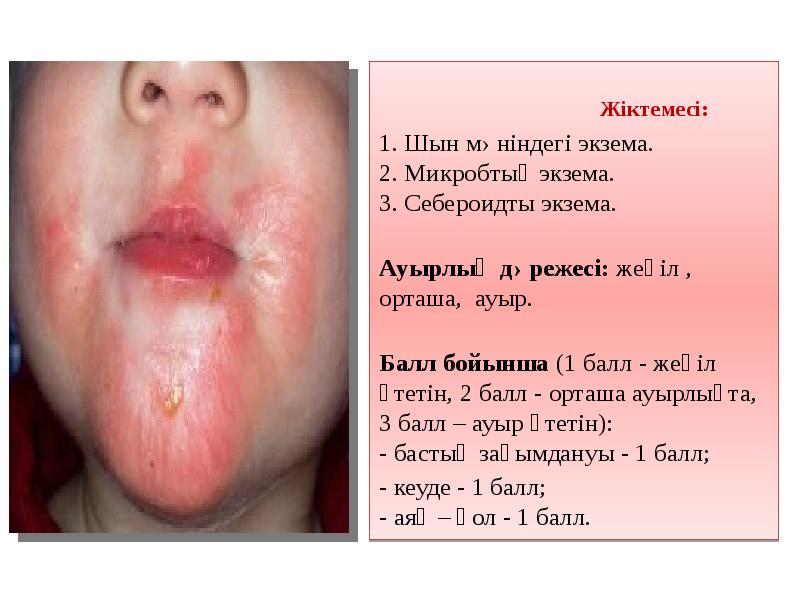 Жіктемесі:
Жіктемесі: