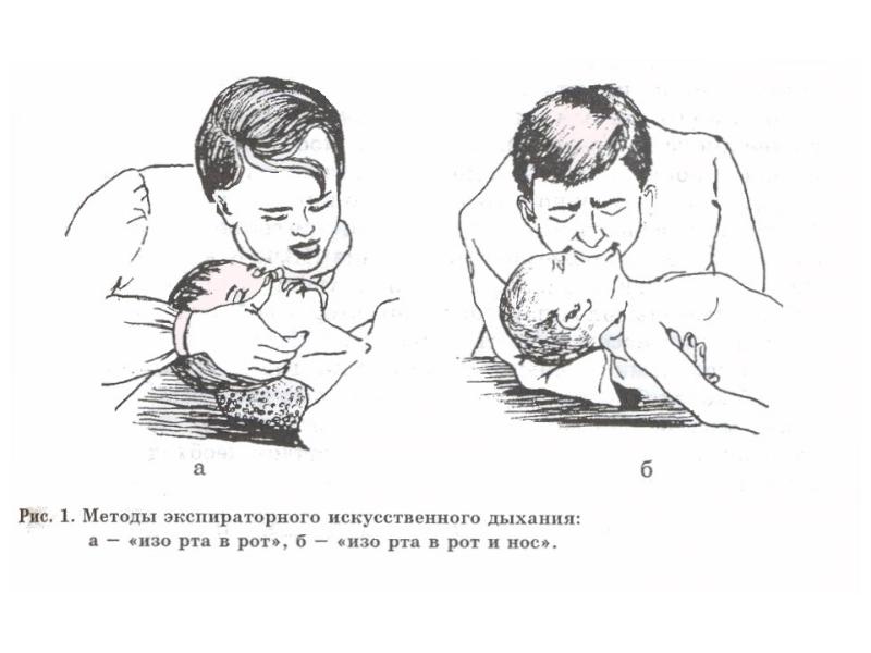 Неотложные состояния в педиатрии презентация