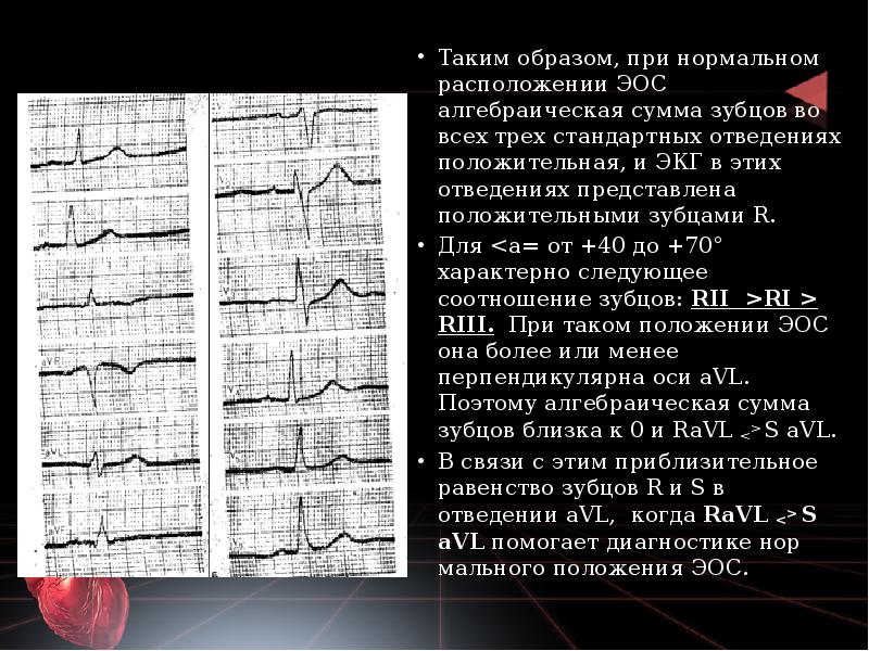 Таким образом, при нормальном расположении ЭОС алгебраическая сумма зубцов во всех Таким образом, при нормальном расположении ЭОС алгебраическая сумма зубцов во всех