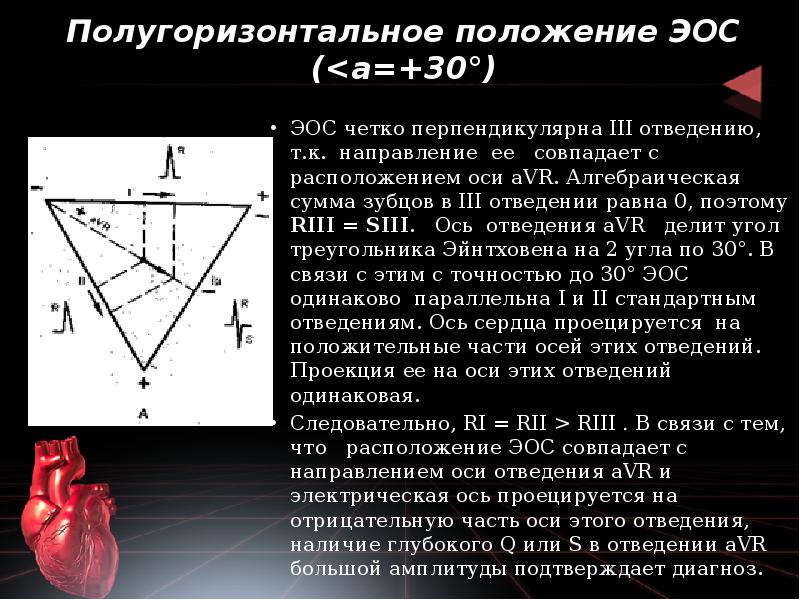 Полугоризонтальное положение ЭОС (<а=+30°)
ЭОС четко перпендикулярна III отведению, т.к. Полугоризонтальное положение ЭОС (<а=+30°)
ЭОС четко перпендикулярна III отведению, т.к.