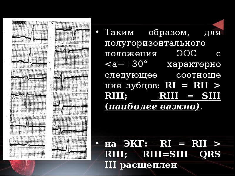 Таким образом, для полугоризонтального положения ЭОС с <а=+30° характерно следующее соотношение Таким образом, для полугоризонтального положения ЭОС с <а=+30° характерно следующее соотношение