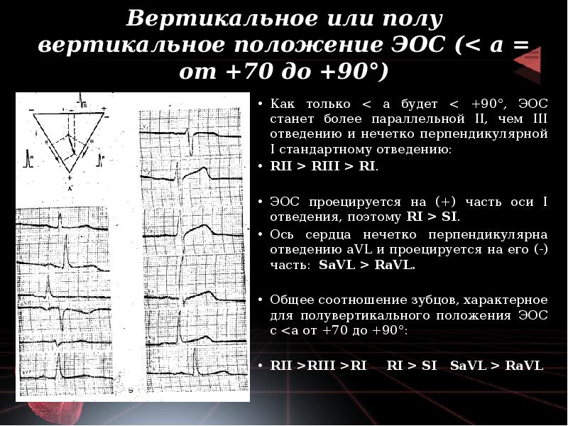 Вертикальное или полувертикальное положение ЭОС (< а = от +70 до Вертикальное или полувертикальное положение ЭОС (< а = от +70 до