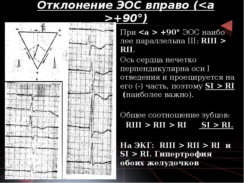 Отклонение ЭОС вправо (<а >+90°)
При <а > +90° ЭОС Отклонение ЭОС вправо (<а >+90°)
При <а > +90° ЭОС