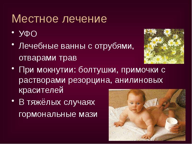 Местное лечение
УФО
Лечебные ванны с отрубями,
отварами трав
При мокнутии: Местное лечение
УФО
Лечебные ванны с отрубями,
отварами трав
При мокнутии: