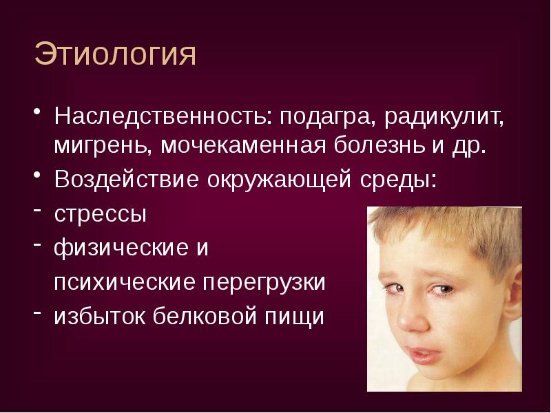 Этиология
Наследственность: подагра, радикулит, мигрень, мочекаменная болезнь и др.
Воздействие Этиология
Наследственность: подагра, радикулит, мигрень, мочекаменная болезнь и др.
Воздействие