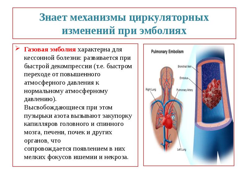 Тромбоз и эмболия. Газовая эмболия кессонная болезнь. Воздушная эмболия механизм развития. Газовая эмболия при кессонной болезни. Газовой эмболия причины возникновения.