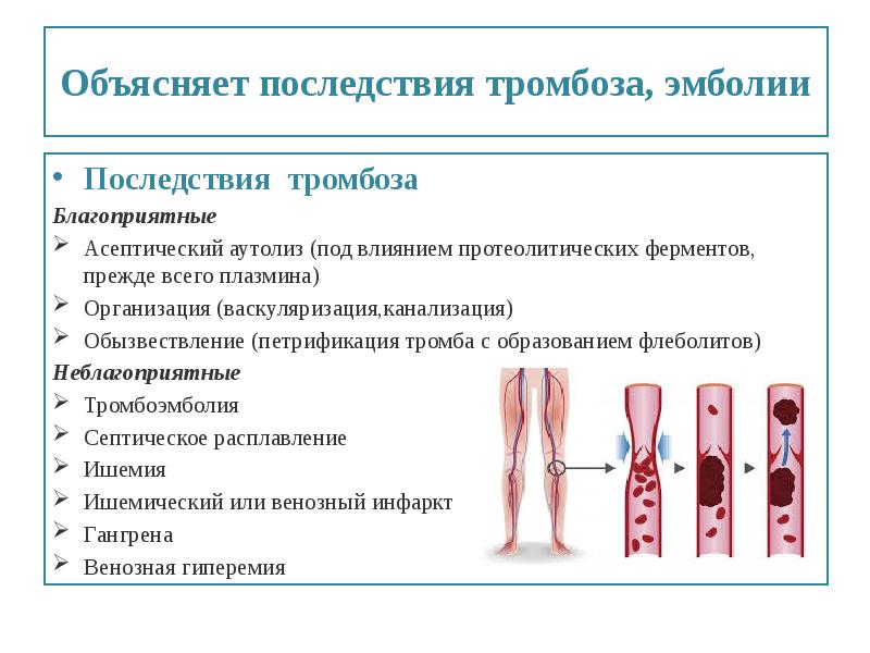 Тромбоз артерий нижних конечностей карта вызова скорой медицинской