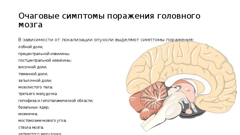 Очаговые симптомы мозга