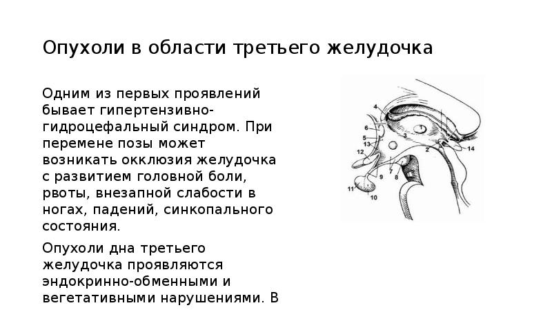 Опухоли нервной системы презентация