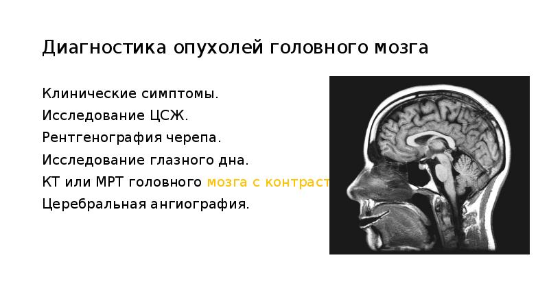 Опухоли нервной системы неврология презентация