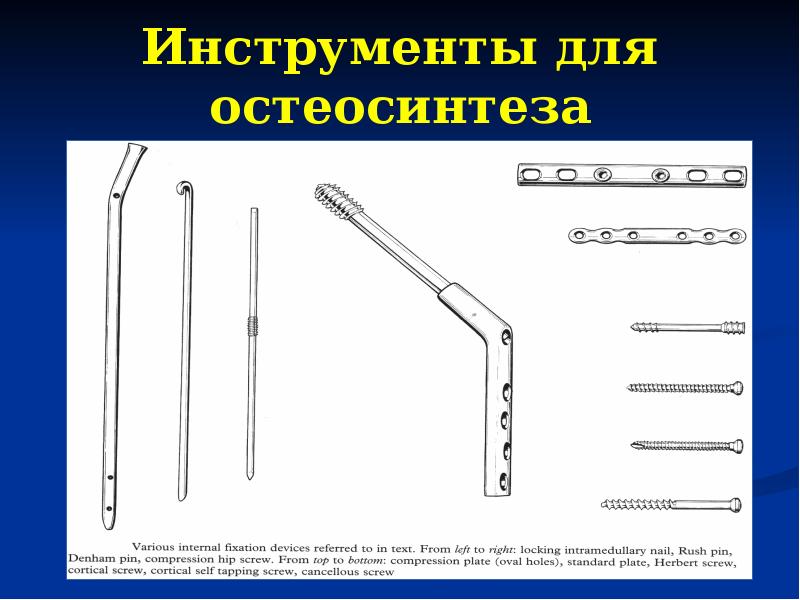 Инструментарий это. Инструменты для экстрамедуллярного остеосинтеза. Инструменты травматология остеосинтез. Хирургические инструменты для костей и суставов. Остеосинтез классификация.