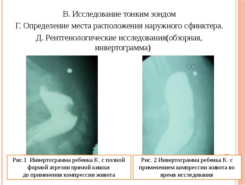 Гиршпрунга рассел диаграмма