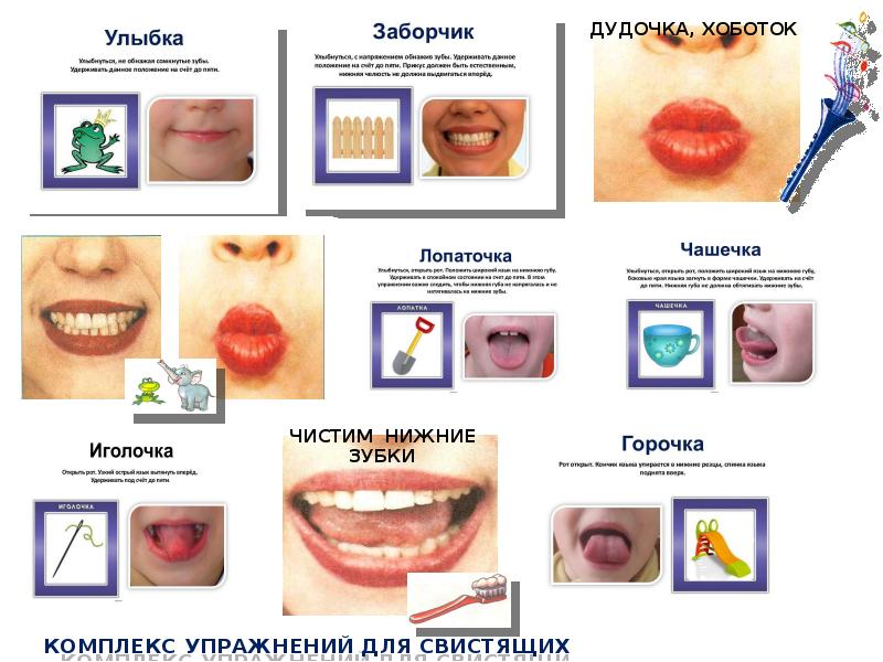 Артикуляционная гимнастика для свистящих звуков презентация