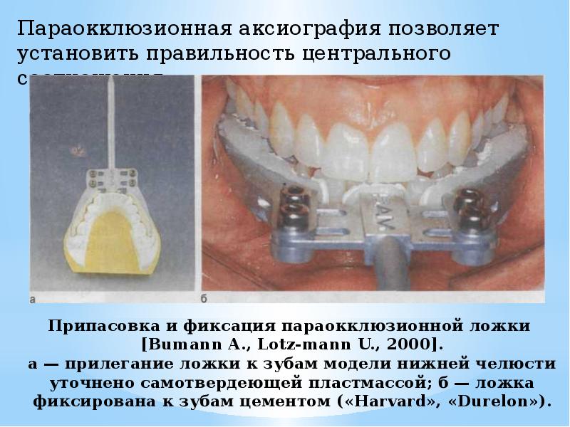 Аксиография в стоматологии презентация