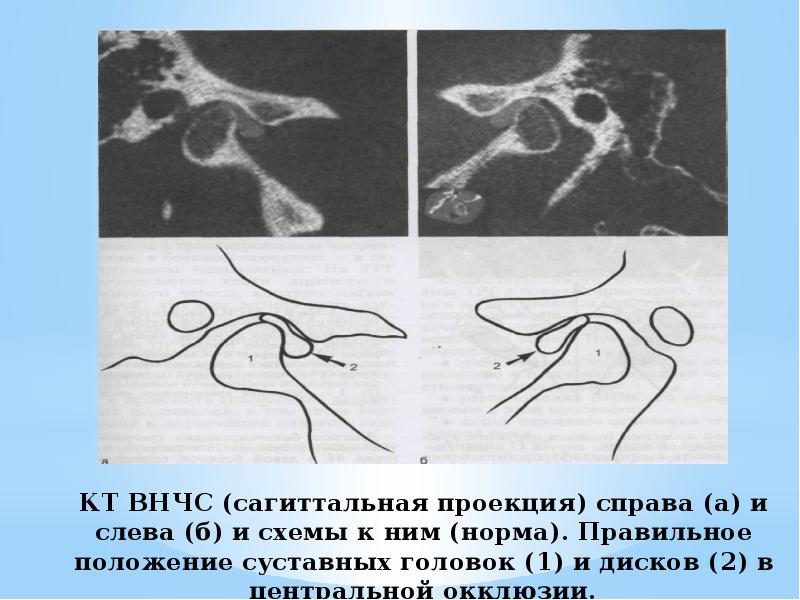 Презентация мрт внчс