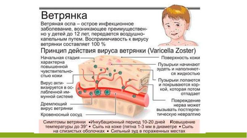 Ветрянка у детей информация для родителей симптомы и лечение картинки начало фото и описание лечение