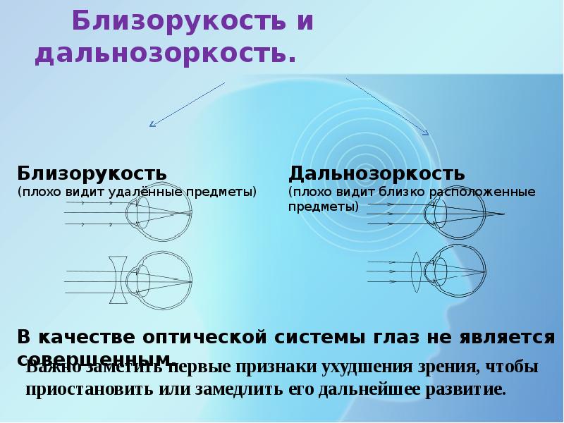 Какие способы устранения нарушений зрения предложены на рисунках