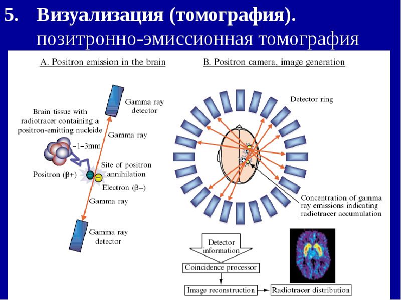 Визуализация (томография). позитронно-эмиссионная томография Визуализация (томография). позитронно-эмиссионная томография