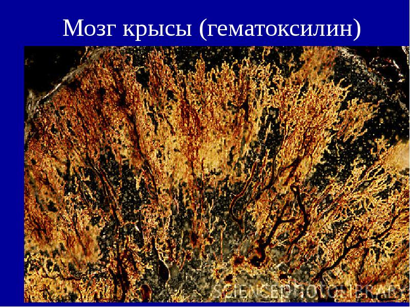 Мозг крысы (гематоксилин) Мозг крысы (гематоксилин)