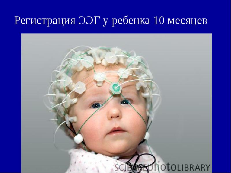 Регистрация ЭЭГ у ребенка 10 месяцев Регистрация ЭЭГ у ребенка 10 месяцев