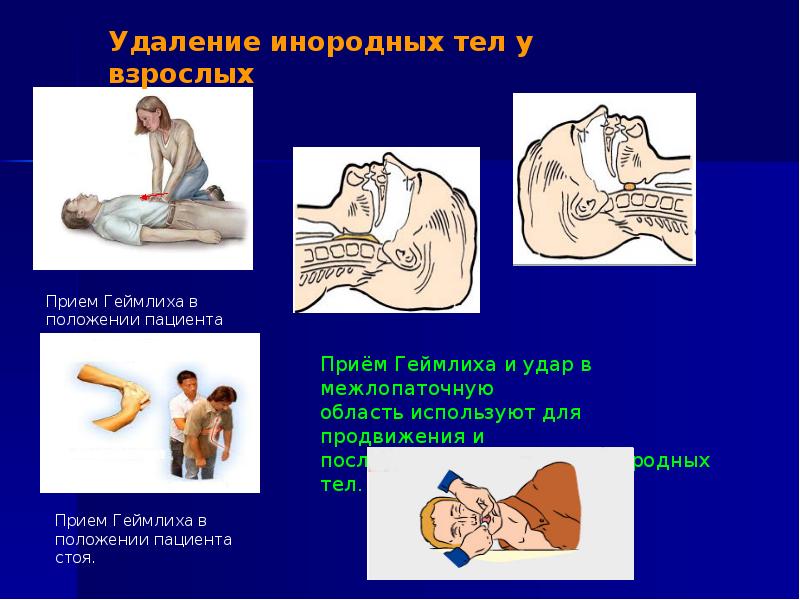 Реанимация картинки для презентации