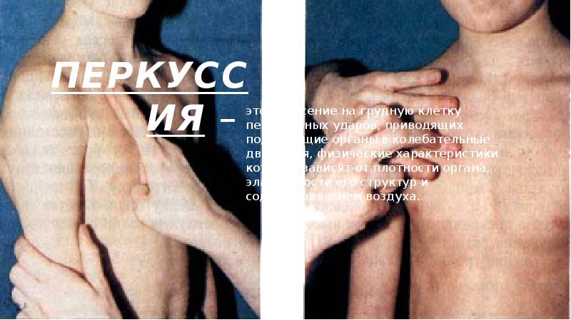ПЕРКУССИЯ –
это нанесение на грудную клетку перкуторных ударов, приводящих ПЕРКУССИЯ –
это нанесение на грудную клетку перкуторных ударов, приводящих