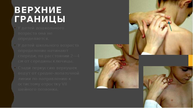 Верхние границы
У детей дошкольного возраста она не определяется.
У детей Верхние границы
У детей дошкольного возраста она не определяется.
У детей