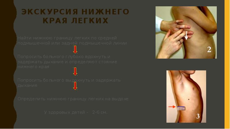 Экскурсия нижнего края легких
Найти нижнюю границу легких по средней подмышечной Экскурсия нижнего края легких
Найти нижнюю границу легких по средней подмышечной