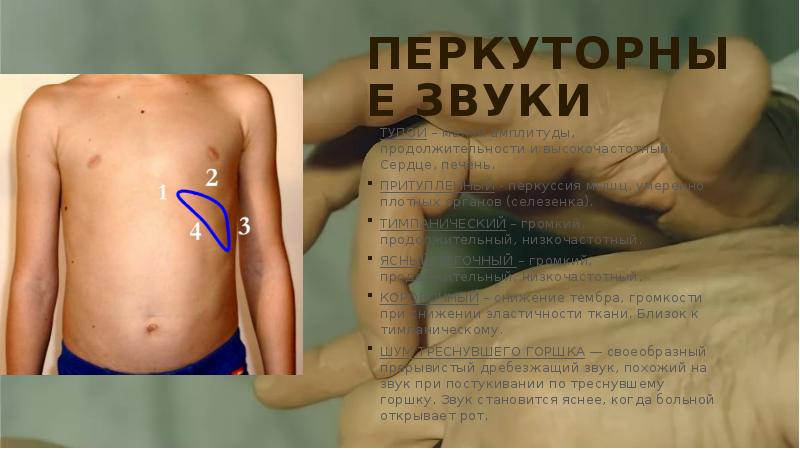 Перкуторные звуки
ТУПОЙ – малой амплитуды, продолжительности и высокочастотный. Сердце, печень. Перкуторные звуки
ТУПОЙ – малой амплитуды, продолжительности и высокочастотный. Сердце, печень.