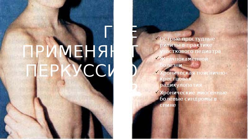 Где применяют перкуссию?
Острые простудные риниты в практике участкового педиатра
Желчнокаменной Где применяют перкуссию?
Острые простудные риниты в практике участкового педиатра
Желчнокаменной