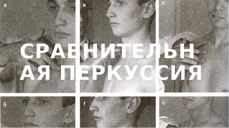 Сравнительная перкуссия Сравнительная перкуссия