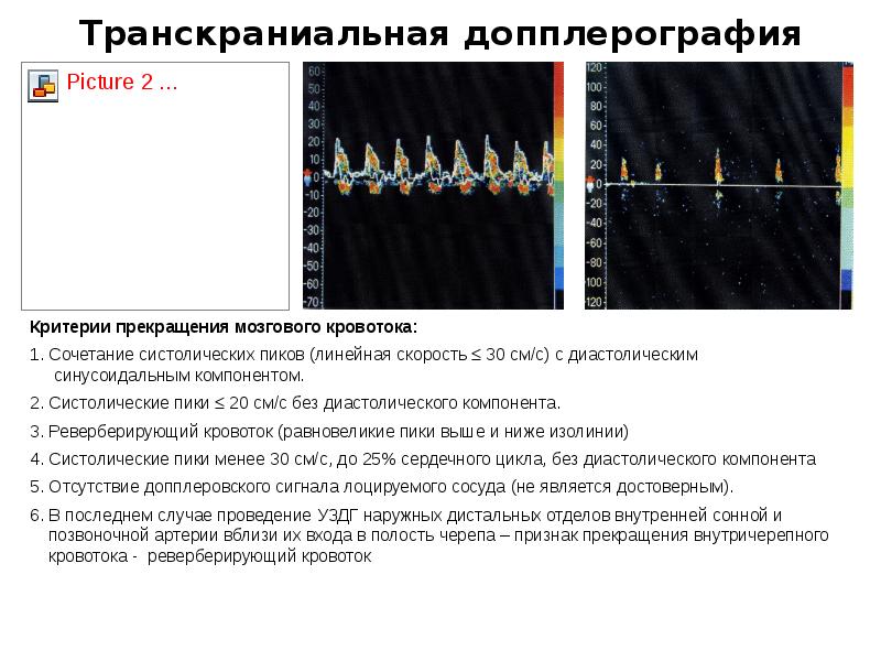 Транскраниальные артерии