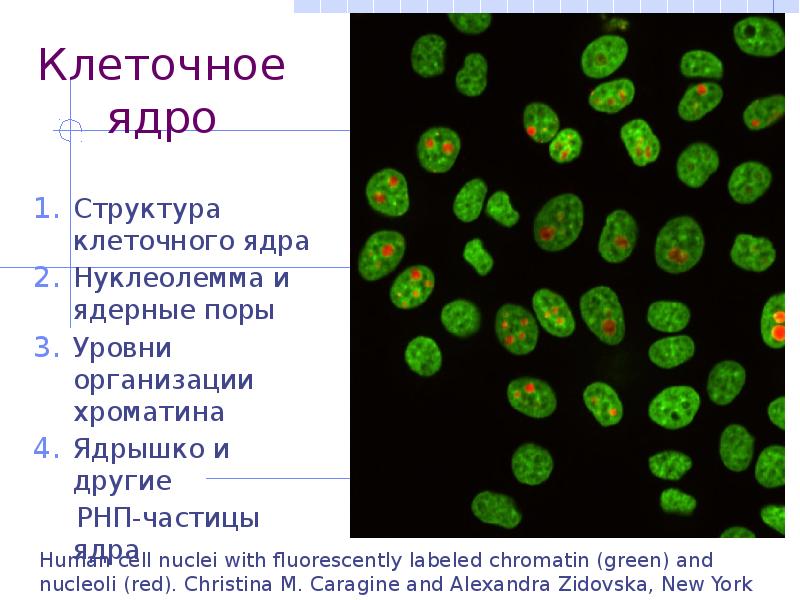 Виды клеток ядра. Вид клеток и ядра. Типы клеточных ядер. Нуклеолемма. Рексисом ядер клеток и ядер.