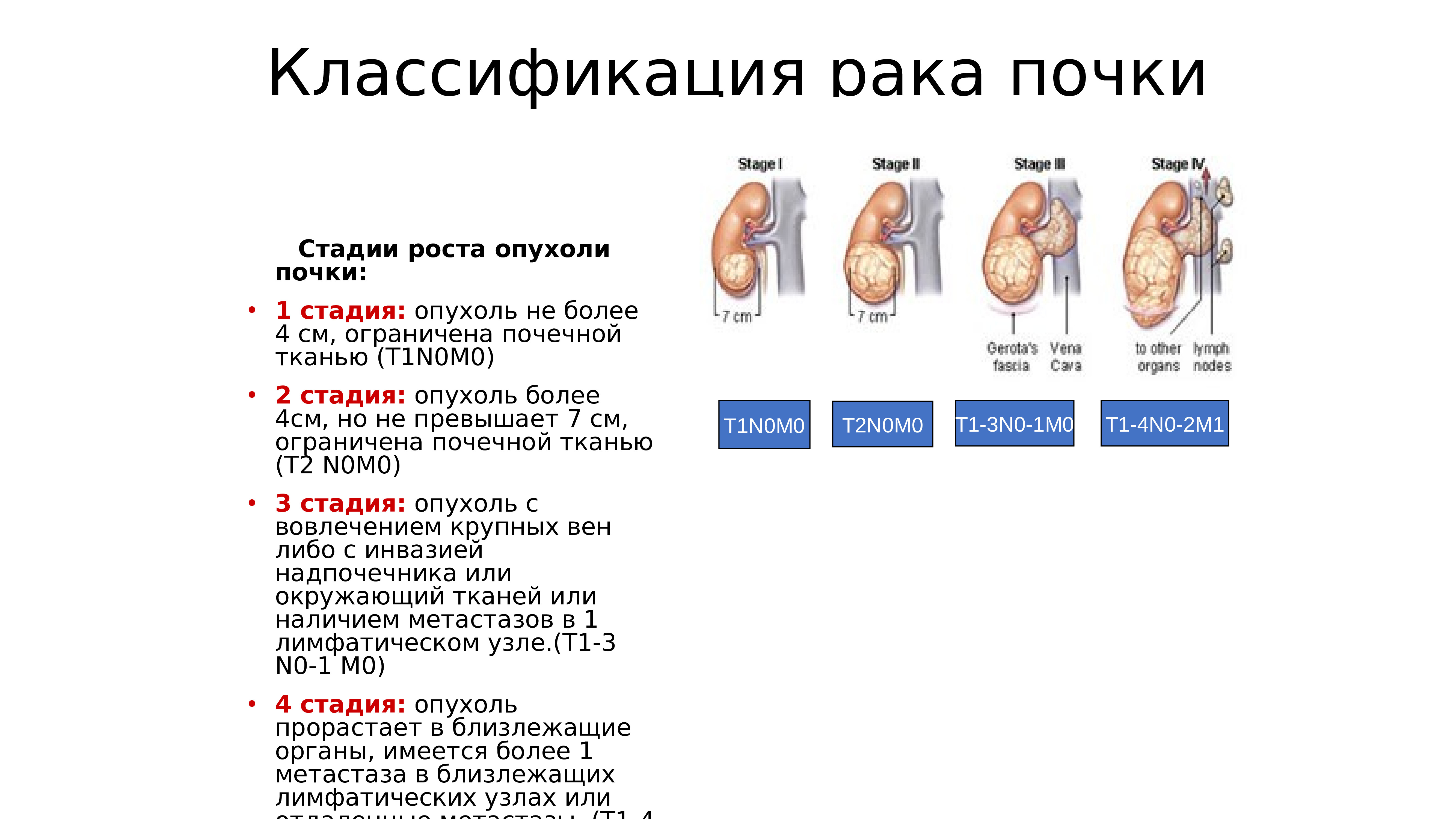 Первая стадия рака. Опухоль почки презентация. Размеры опухоли почки по стадиям. Онкология почек стадии. Онкология почки 1 стадия.