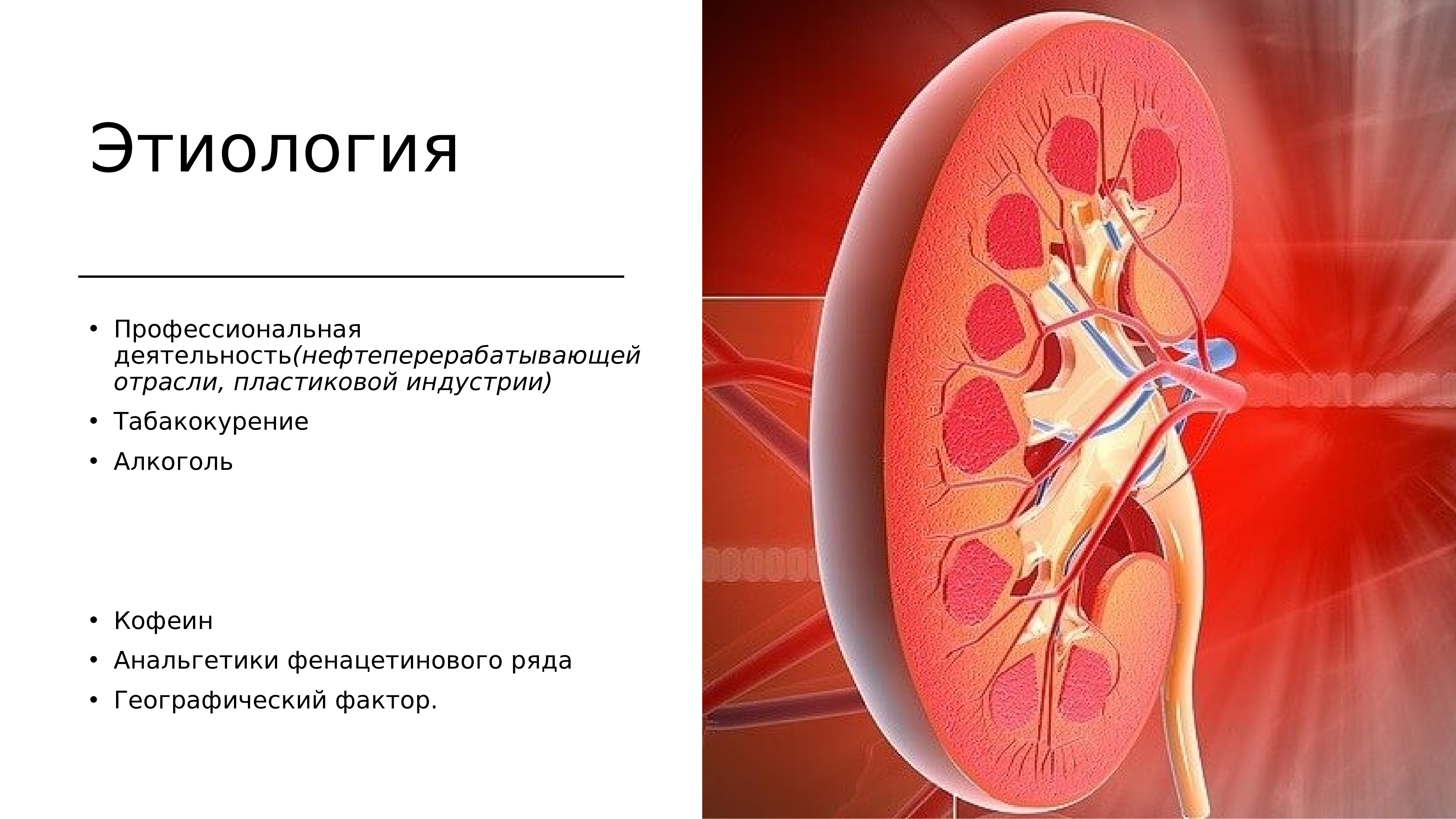 Опухоли почек презентация