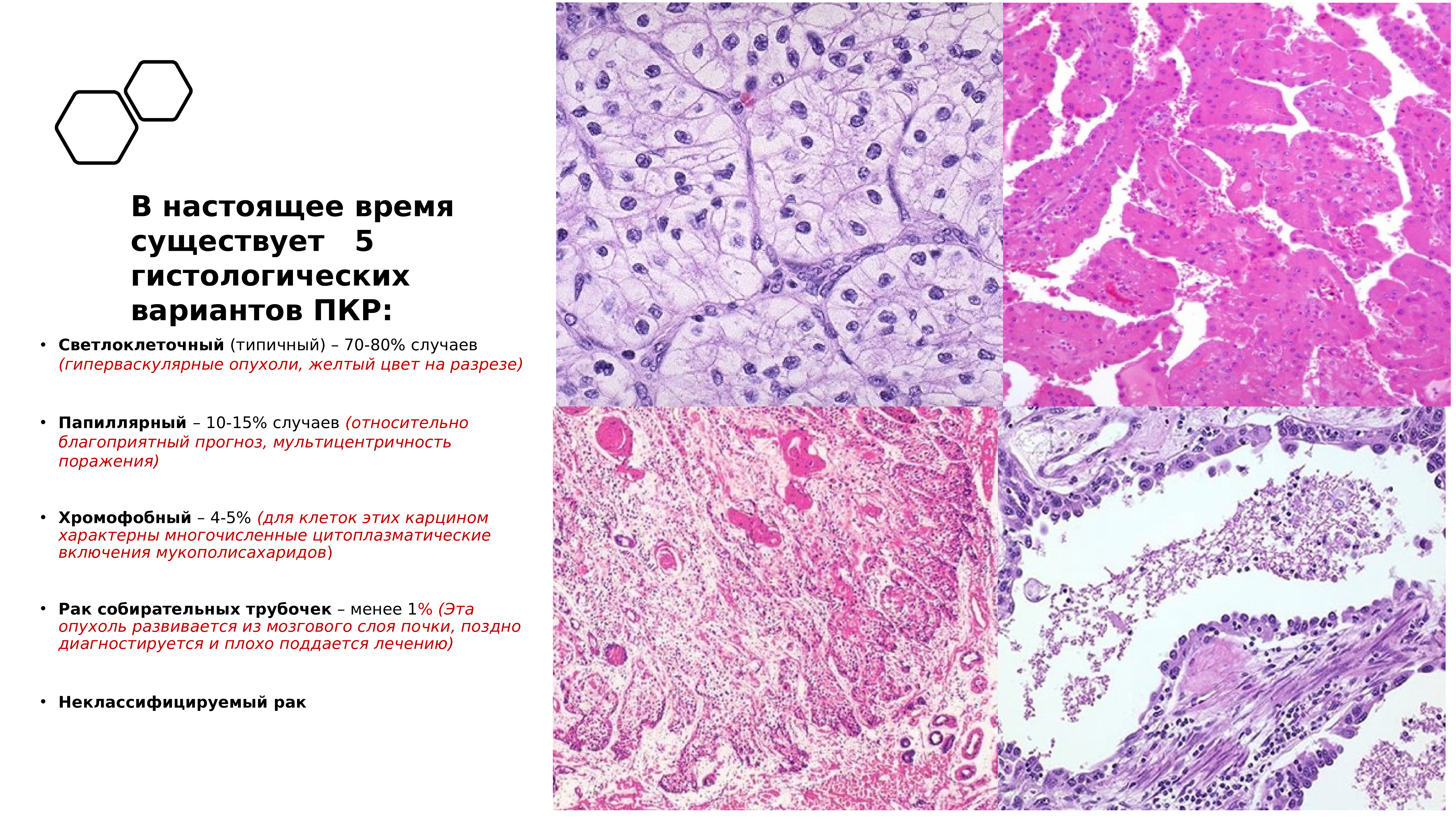 Гистологические формы рака