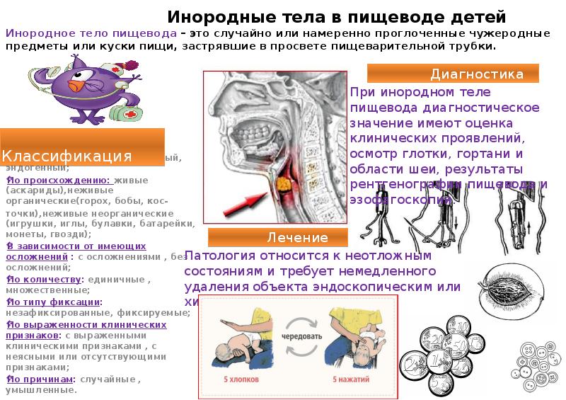 Инородное тело глаза карта смп - 97 фото