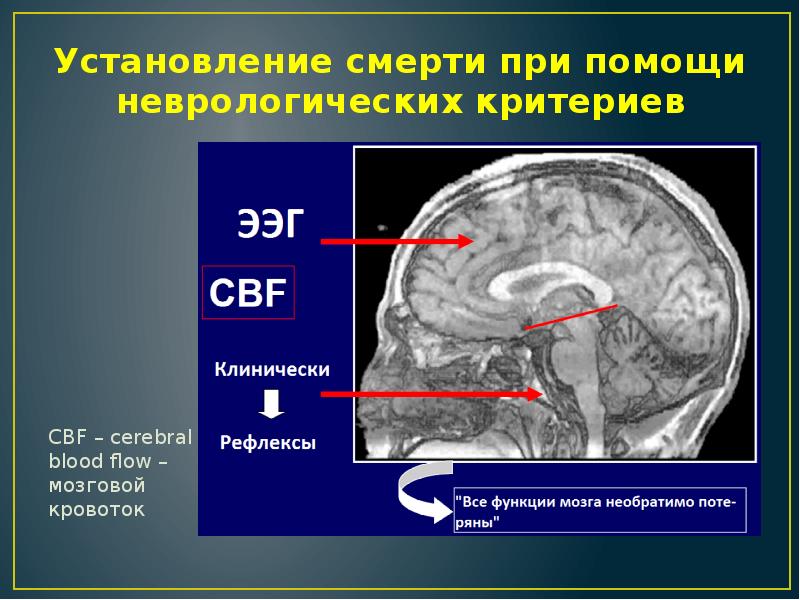 Смерть мозга презентация