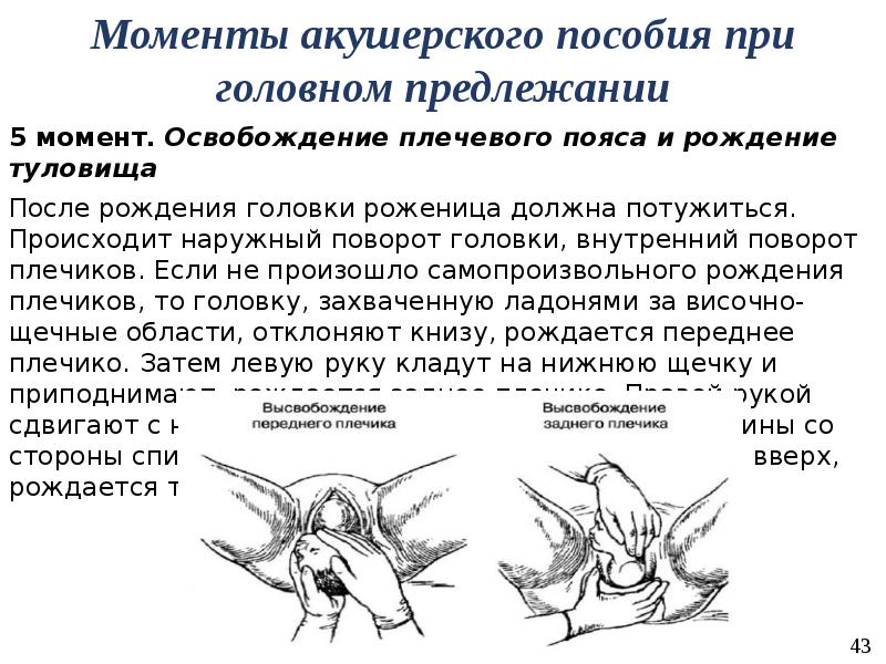 Акушерское пособие при головном