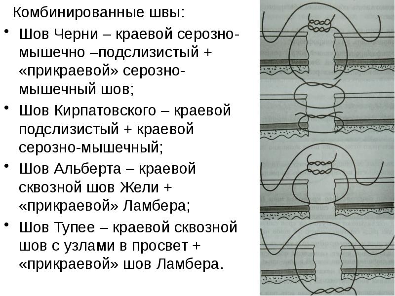 Кишечные швы топографическая анатомия презентация