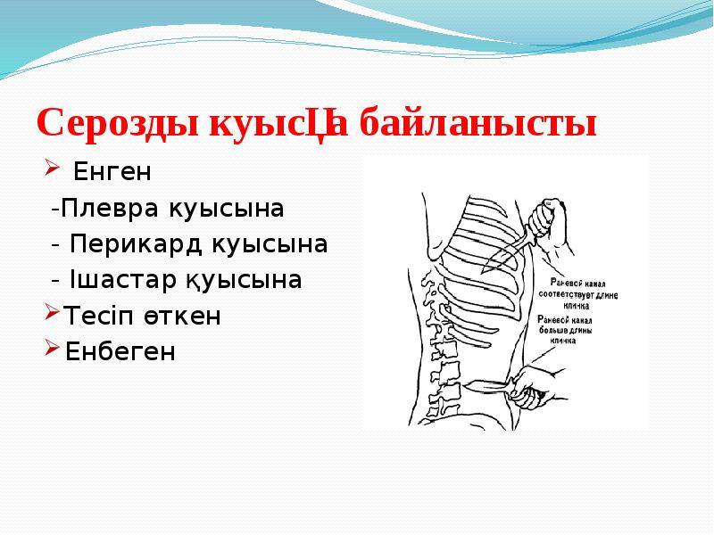 Серозды куысқа байланысты  Енген  -Плевра куысына  - Перикард