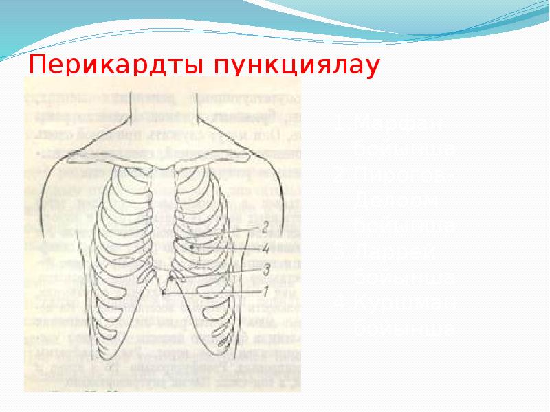 Перикардты пункциялау