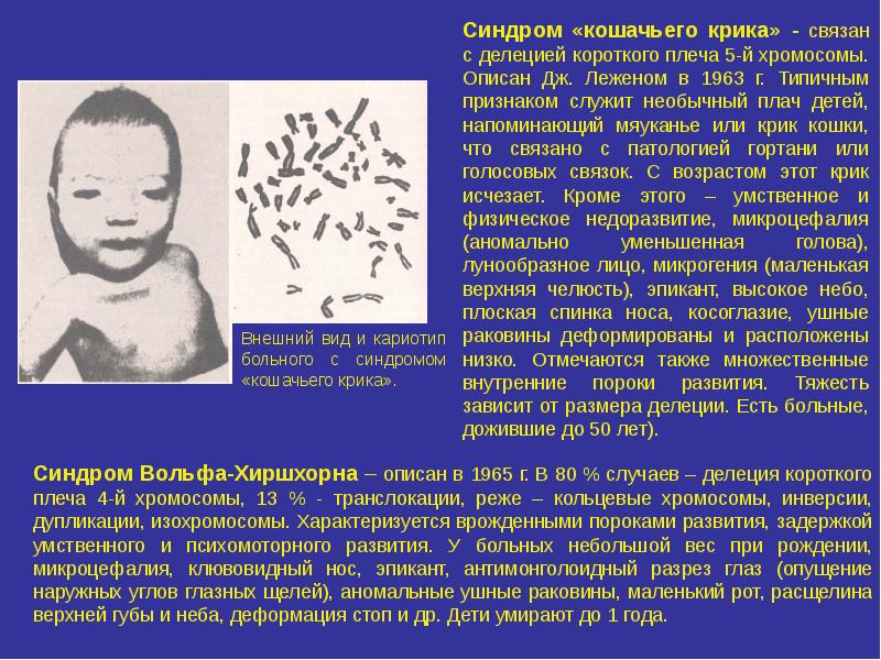 Синдром орбели презентация