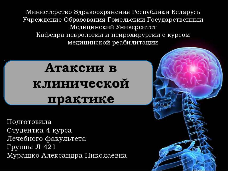 Атаксии в клинической практике