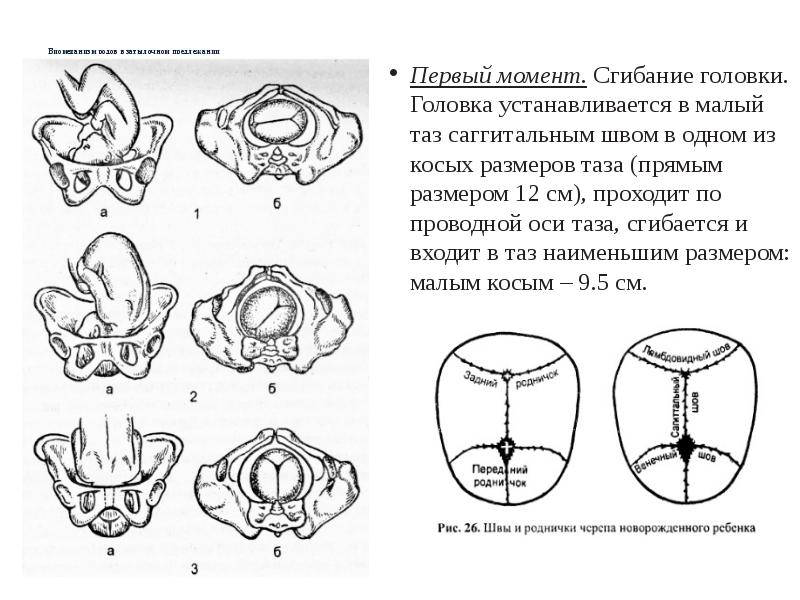 Предлежание в малом тазу. Передний вид затылочного предлежания. Первый момент сгибание головки. Задний вид затылочного предлежания. Биомеханизм родов при переднем виде затылочного предлежания.