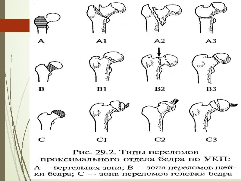 Шейка бедра карта вызова