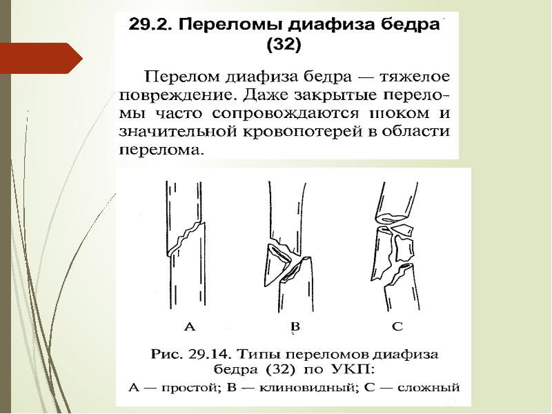 Переломы бедра презентация